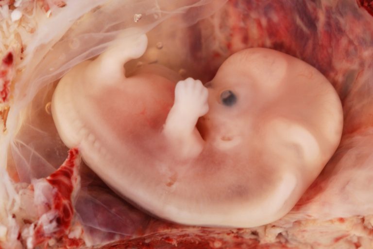 Човешки ембрион на 7 седмици
