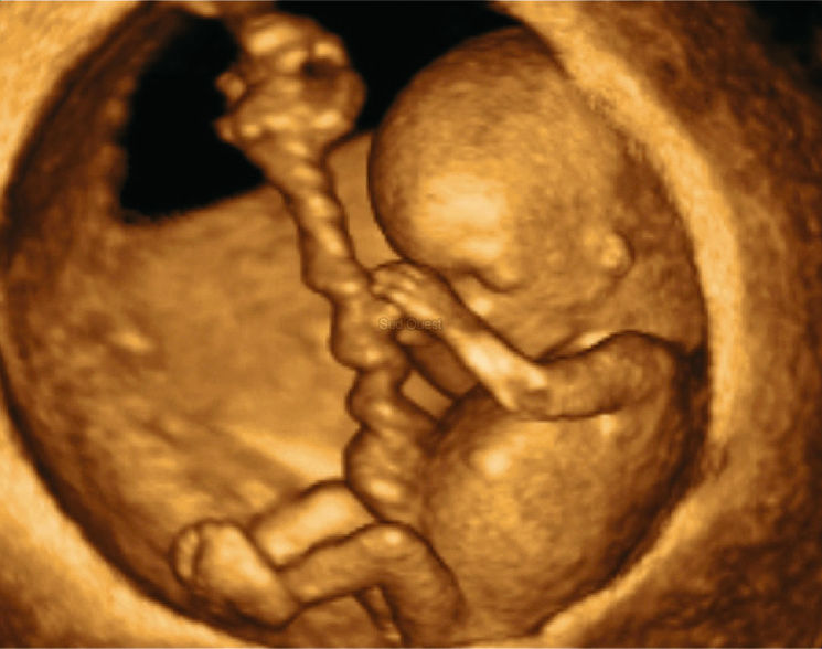 Бебе в утробата - 3D ехограф. видеозон