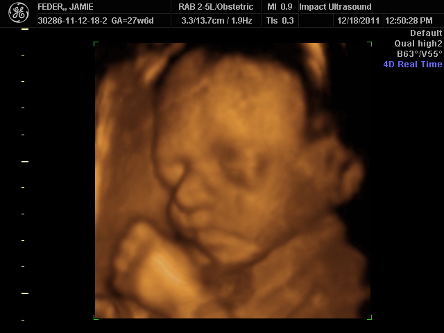 3D ултразвук/ехограф/видеозон на бебе